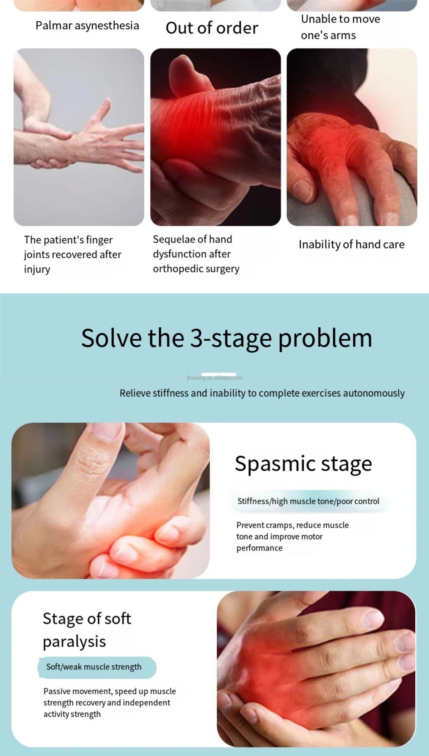 Arm Elbow Joint Multifunctional Combined Rehabilitation Glove Stroke Hemiplegia Cerebral Infarction Flexion Extension Training